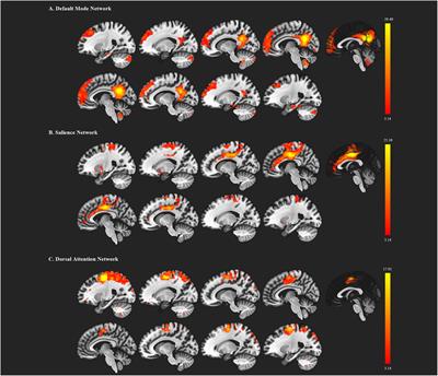 Reduced Dynamic Interactions Within Intrinsic Functional Brain Networks in Early Blind Patients